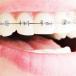 Traitement ostéopathique et orthodontie